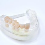 dentallabor-millwood-produkte-31