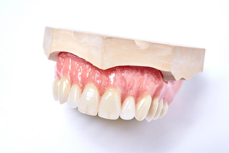 dentallabor-millwood-produkte-35