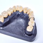 dentallabor-millwood-produkte-39